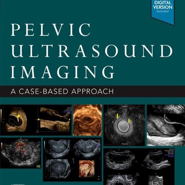 Pelvic Ultrasound Imaging: A&hellip;