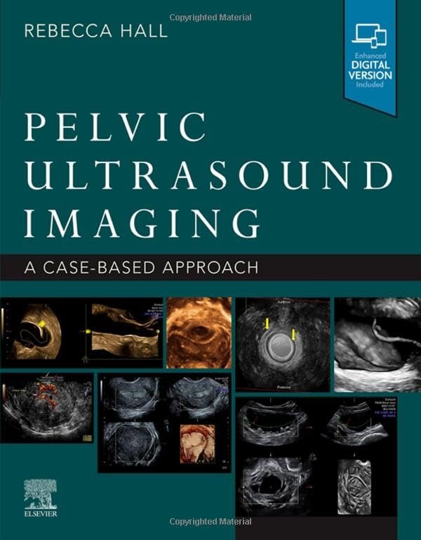 Pelvic Ultrasound Imaging: A Cased-Based Approach